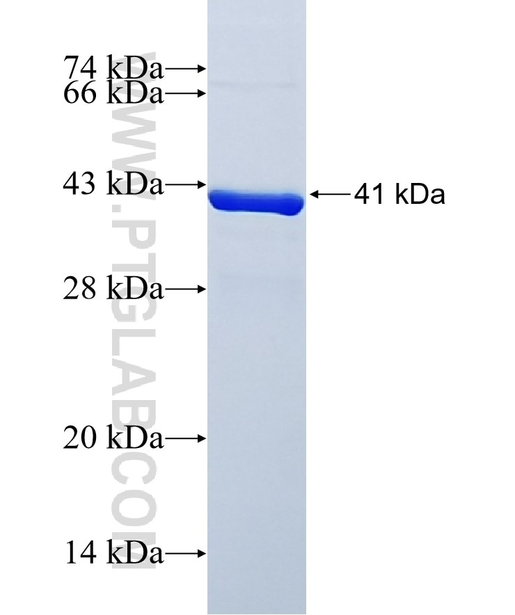 KIF20B fusion protein Ag26191 SDS-PAGE