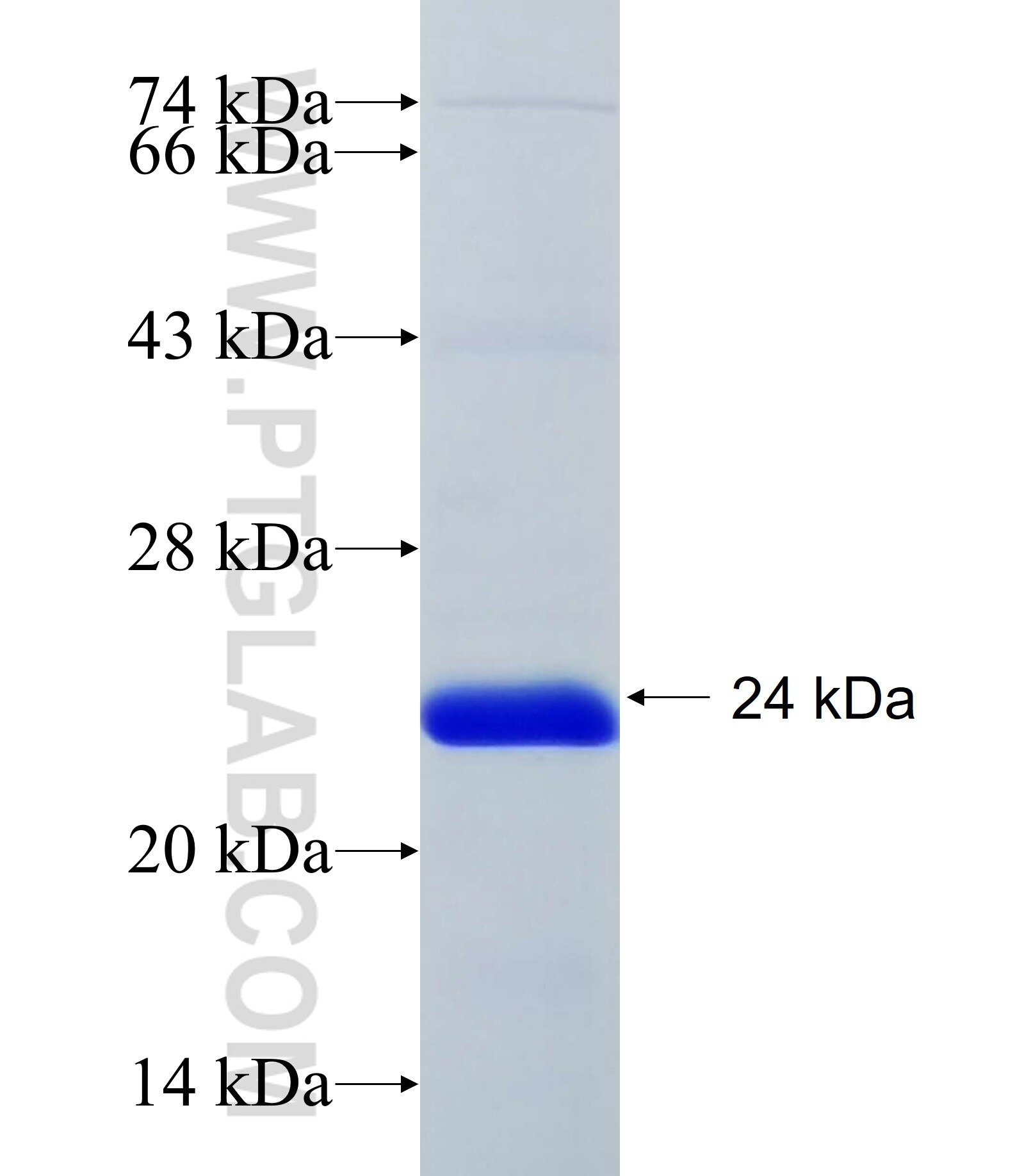 KIF20B fusion protein Ag34105 SDS-PAGE