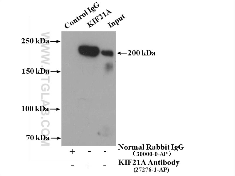 Immunoprecipitation (IP) experiment of mouse brain tissue using KIF21A Polyclonal antibody (27276-1-AP)