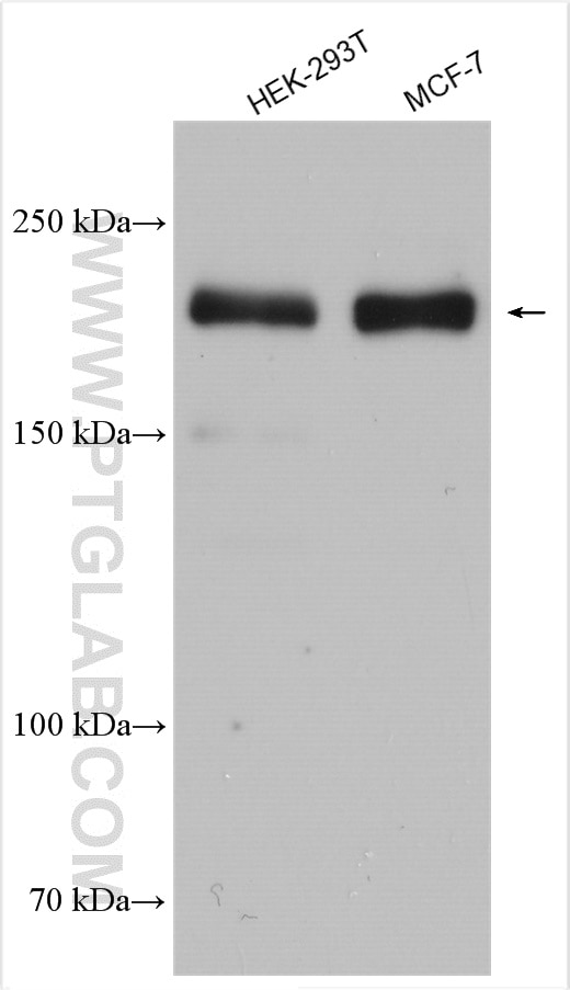 Western Blot (WB) analysis of various lysates using KIF21A Polyclonal antibody (27276-1-AP)