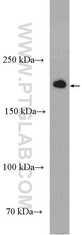 Western Blot (WB) analysis of mouse brain tissue using KIF21A Polyclonal antibody (27276-1-AP)