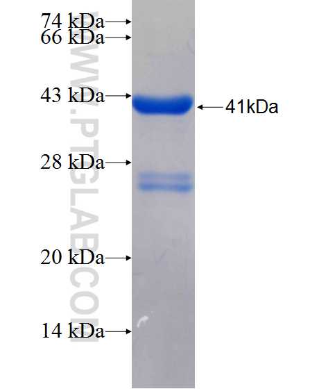 KIF21A fusion protein Ag26192 SDS-PAGE