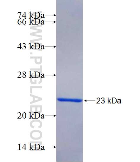 KIF21B fusion protein Ag25470 SDS-PAGE
