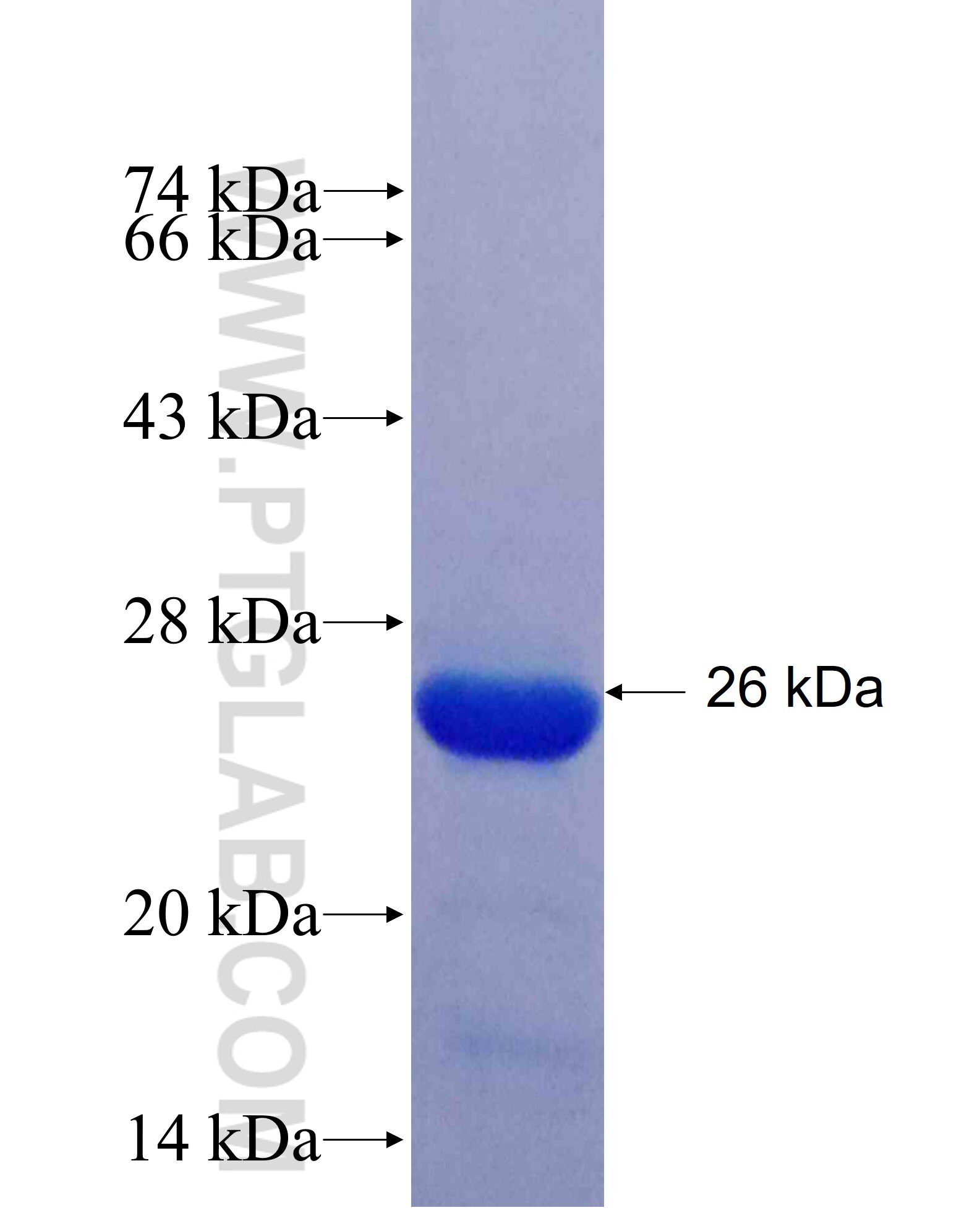 KIF21B fusion protein Ag25470 SDS-PAGE