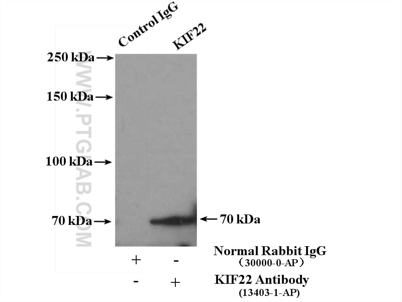 Immunoprecipitation (IP) experiment of HeLa cells using KIF22 Polyclonal antibody (13403-1-AP)