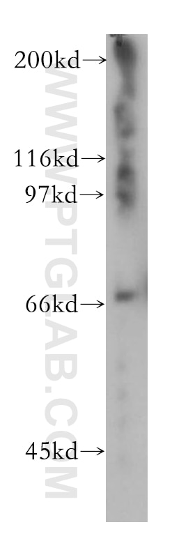 Western Blot (WB) analysis of human heart tissue using KIF22 Polyclonal antibody (13403-1-AP)