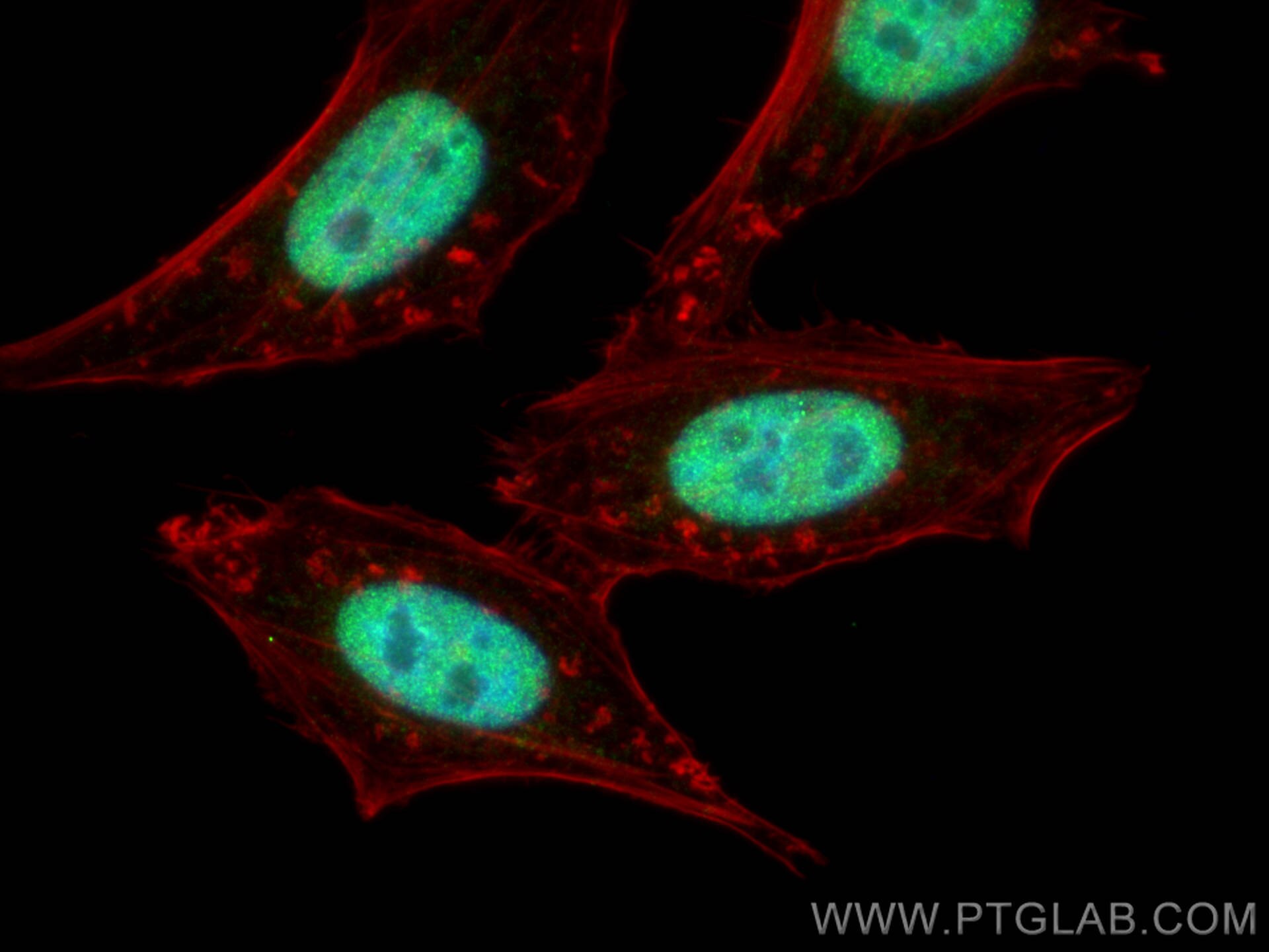 Immunofluorescence (IF) / fluorescent staining of HepG2 cells using KIF23 Polyclonal antibody (28587-1-AP)
