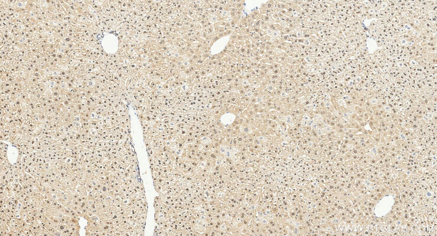 IHC staining of mouse liver using 28587-1-AP Immunohistochemistry (IHC) staining of mouse liver tissue using KIF23 Polyclonal antibody (28587-1-AP)