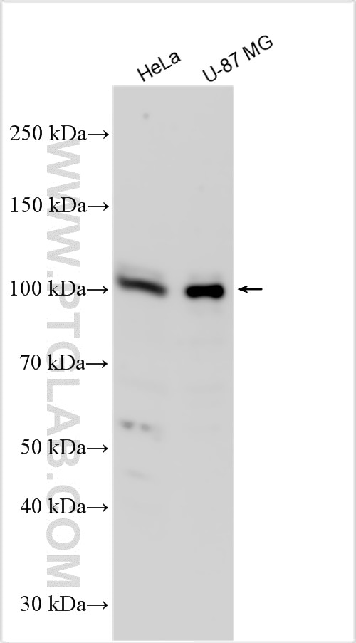 Western Blot (WB) analysis of various lysates using KIF23 Polyclonal antibody (28587-1-AP)