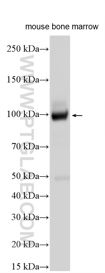 WB analysis using 28587-1-AP Western Blot (WB) analysis of various lysates using KIF23 Polyclonal antibody (28587-1-AP)