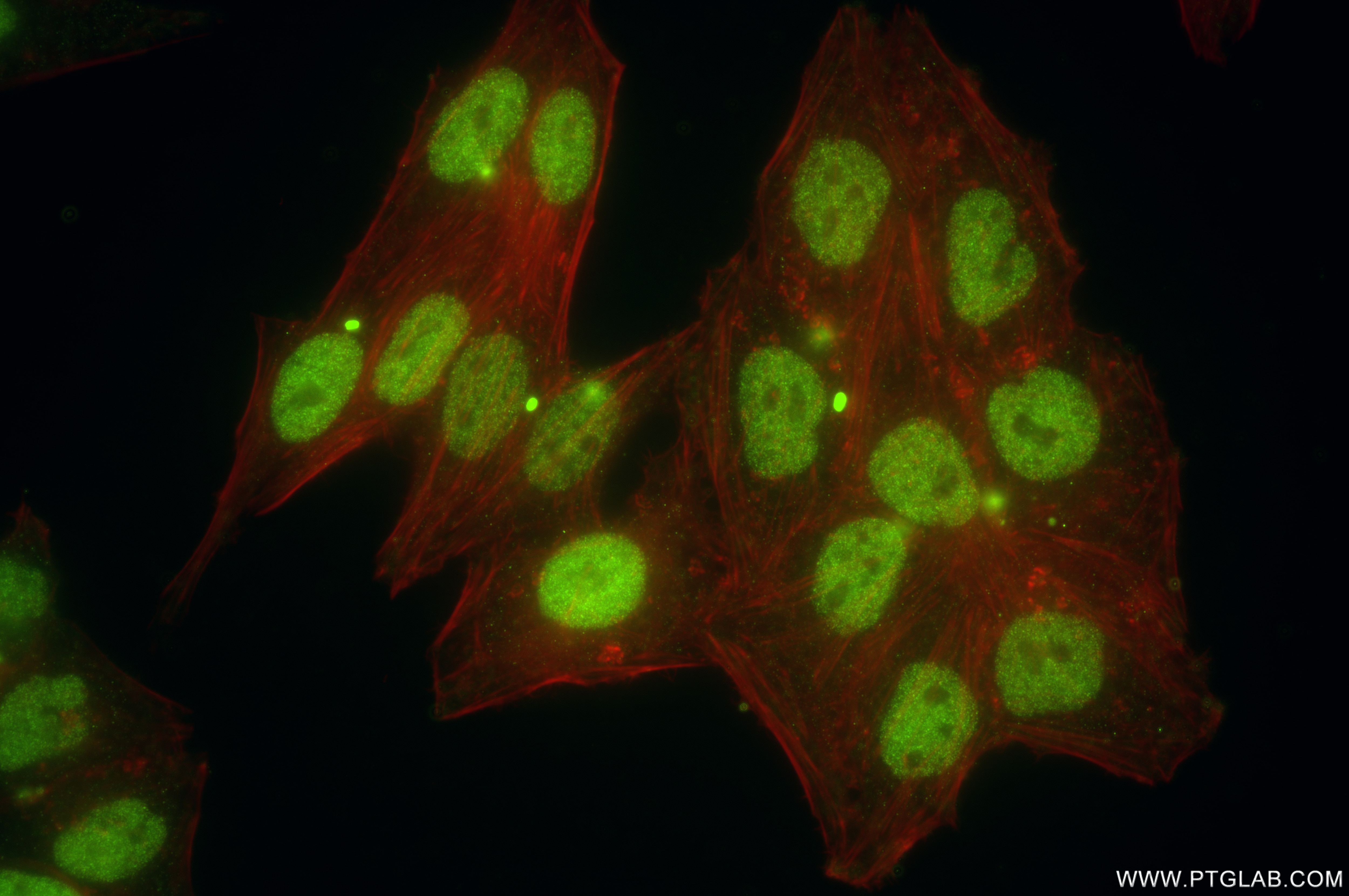 Immunofluorescence (IF) / fluorescent staining of HepG2 cells using KIF23 Recombinant antibody (85675-5-RR)