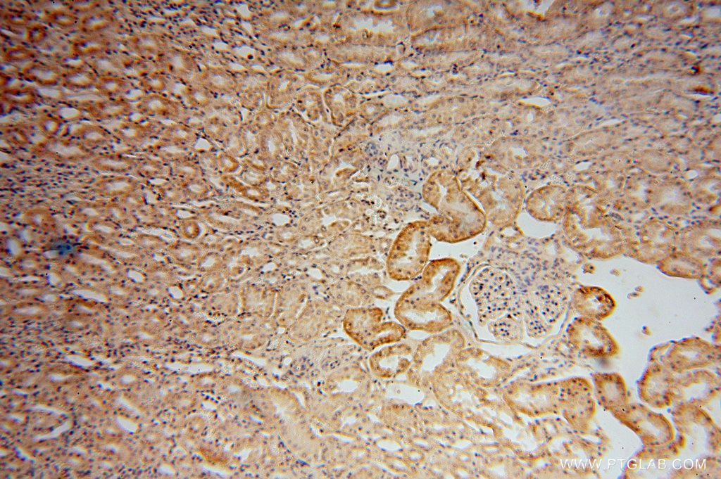 Immunohistochemistry (IHC) staining of human kidney tissue using KIF26B Polyclonal antibody (17422-1-AP)