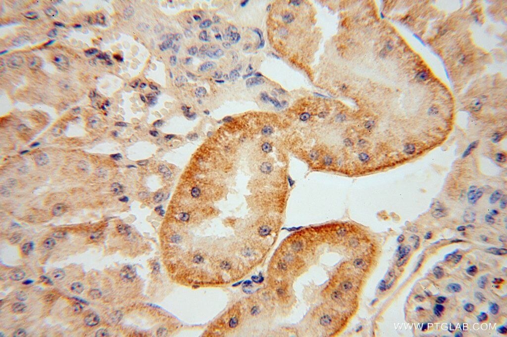 Immunohistochemistry (IHC) staining of human kidney tissue using KIF26B Polyclonal antibody (17422-1-AP)