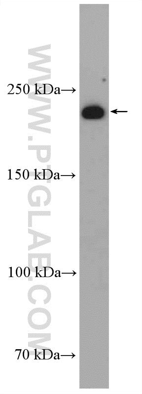 WB analysis of MCF-7 using 17422-1-AP