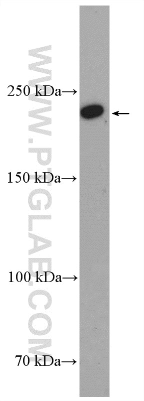 Western Blot (WB) analysis of MDCK cells using KIF26B Polyclonal antibody (17422-1-AP)