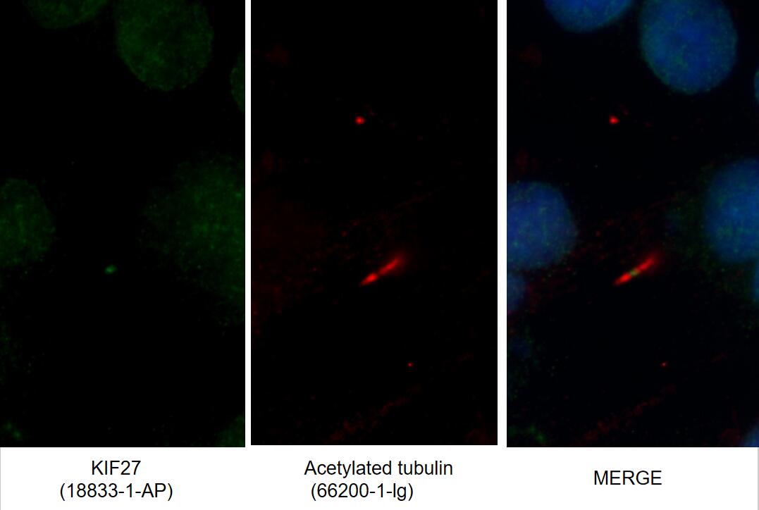 Immunofluorescence (IF) / fluorescent staining of MDCK cells using KIF27 Polyclonal antibody (18833-1-AP)