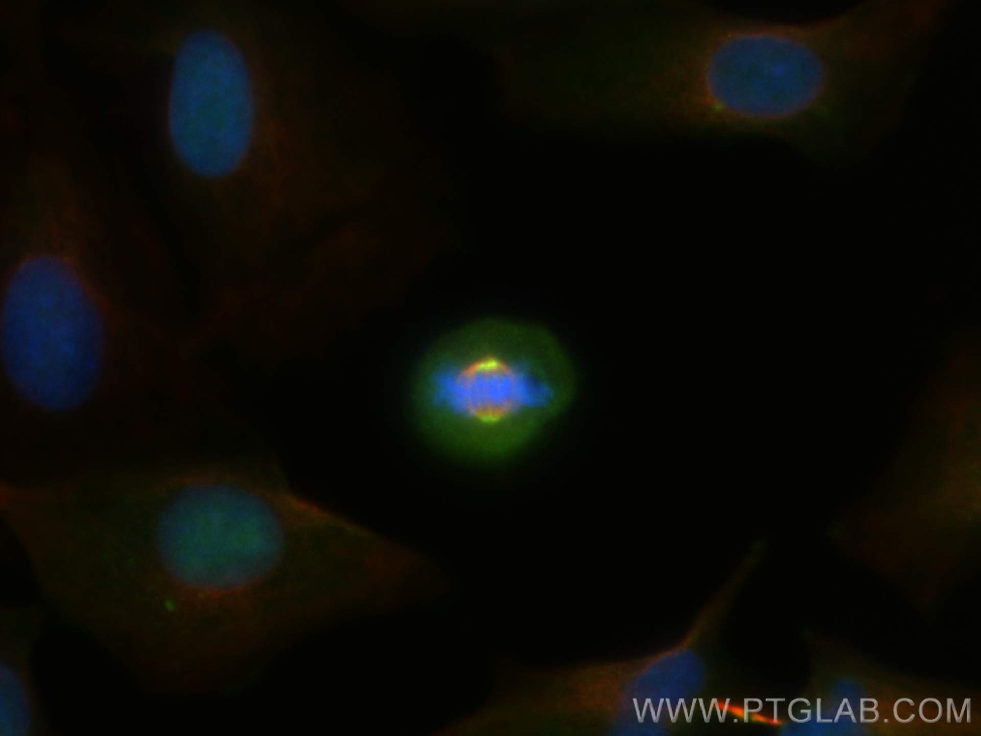 Immunofluorescence (IF) / fluorescent staining of A549 cells using KIF2A Polyclonal antibody (13105-1-AP)