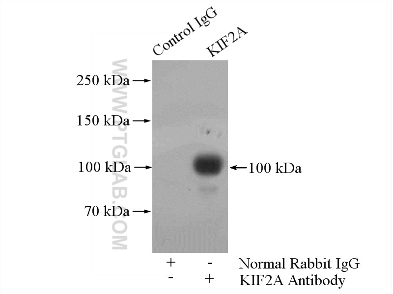 Immunoprecipitation (IP) experiment of mouse brain tissue using KIF2A Polyclonal antibody (13105-1-AP)