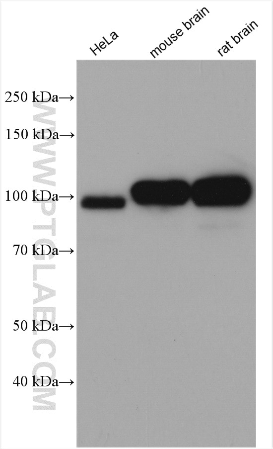 Western Blot (WB) analysis of various lysates using KIF2A Polyclonal antibody (13105-1-AP)