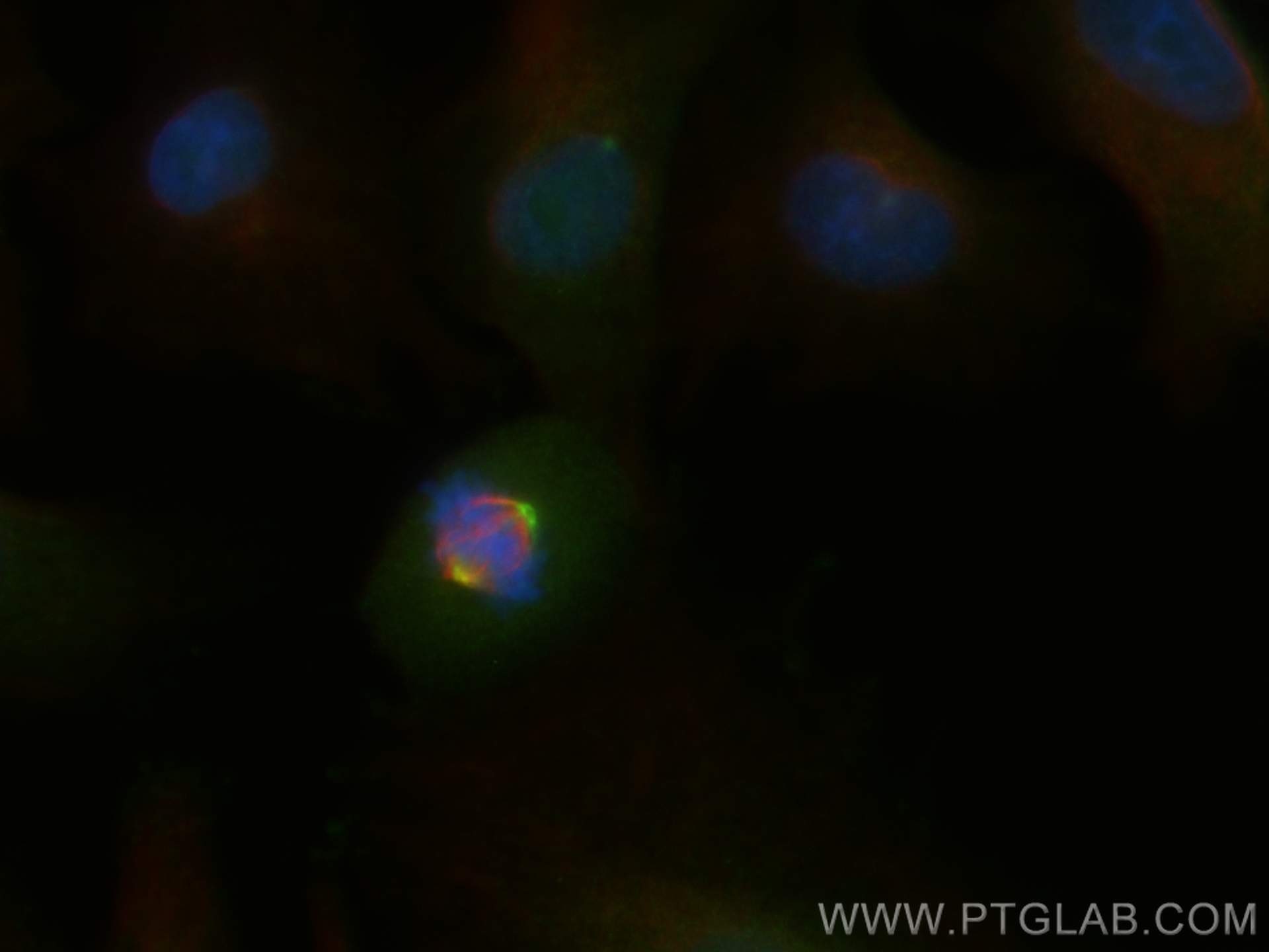 Immunofluorescence (IF) / fluorescent staining of A549 cells using KIF2A Polyclonal antibody (27218-1-AP)