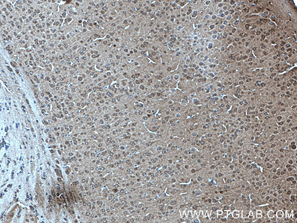 Immunohistochemistry (IHC) staining of mouse brain tissue using KIF2A Polyclonal antibody (27218-1-AP)