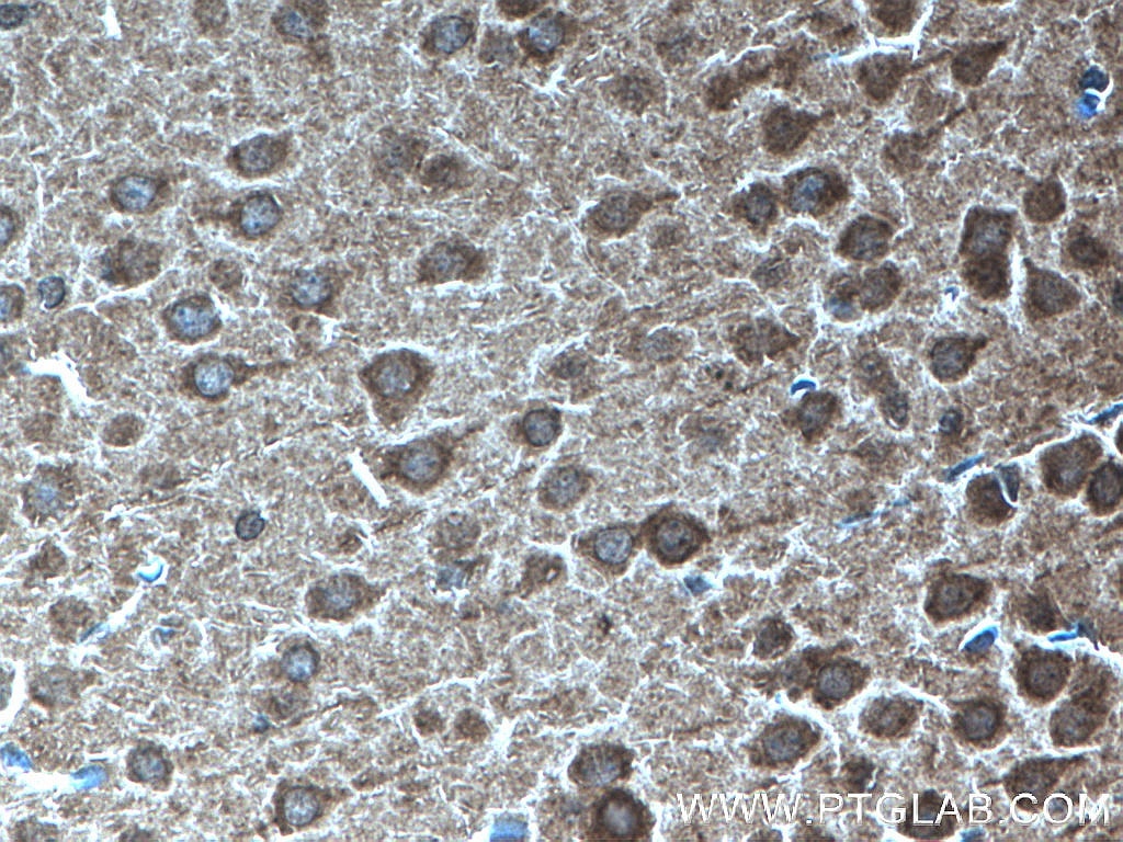 IHC staining of mouse brain using 27218-1-AP