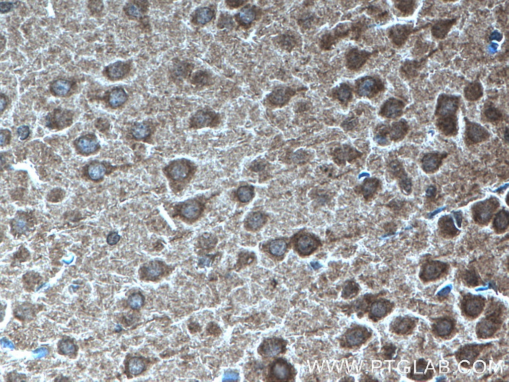 Immunohistochemistry (IHC) staining of mouse brain tissue using KIF2A Polyclonal antibody (27218-1-AP)