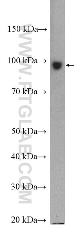 Western Blot (WB) analysis of Jurkat cells using KIF2A Polyclonal antibody (27218-1-AP)