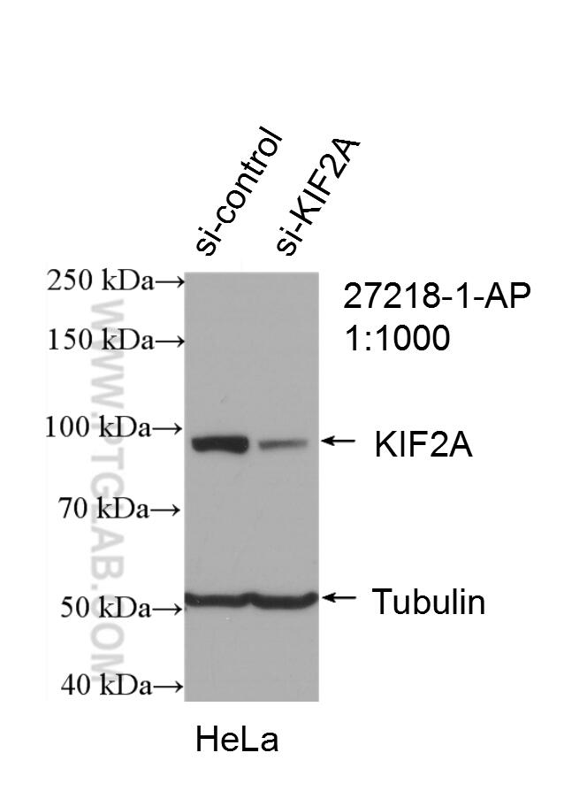 Western Blot (WB) analysis of HeLa cells using KIF2A Polyclonal antibody (27218-1-AP)