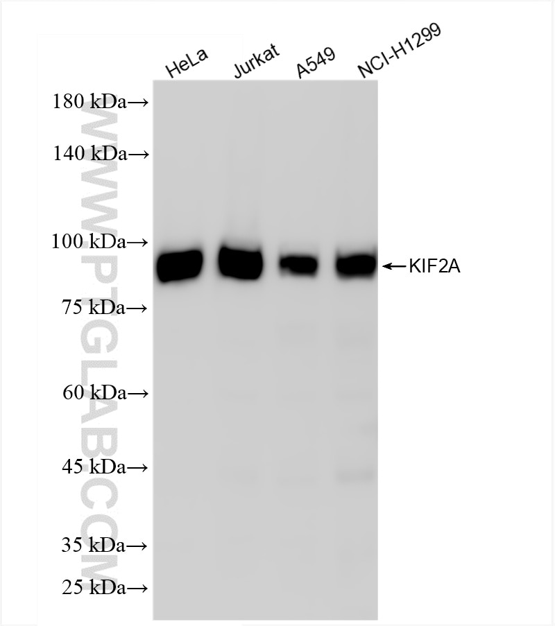 Western Blot (WB) analysis of various lysates using KIF2A Recombinant antibody (86268-3-RR)