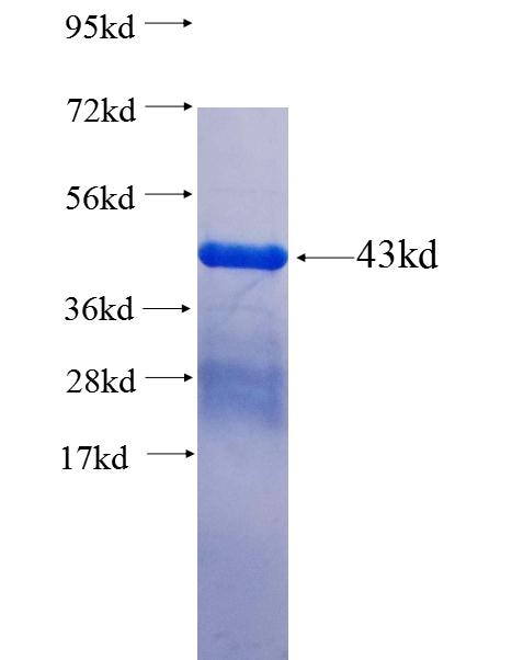 KIF2A fusion protein Ag25692 SDS-PAGE