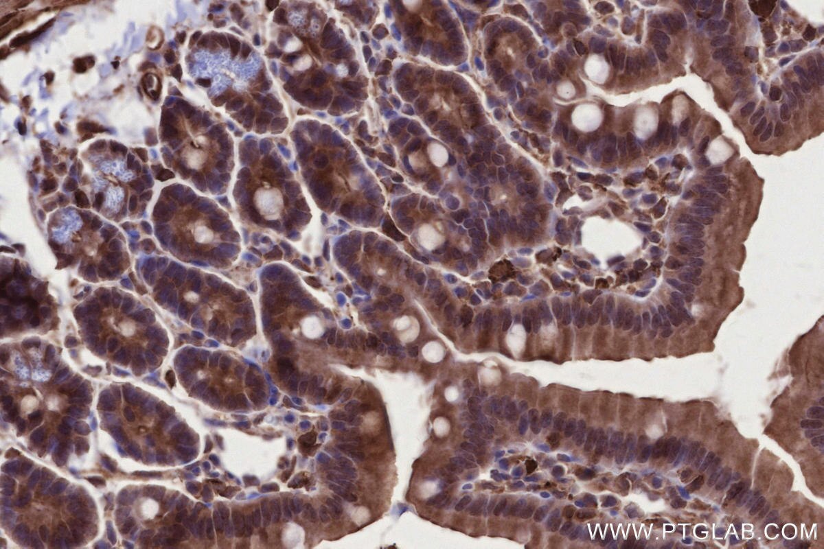 Immunohistochemistry (IHC) staining of mouse small intestine tissue using KIF2B Polyclonal antibody (13711-1-AP)