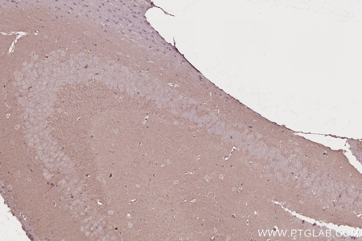 Immunohistochemistry (IHC) staining of mouse brain tissue using KIF2B Polyclonal antibody (13711-1-AP)