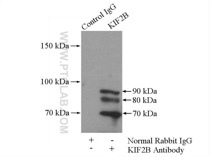 Immunoprecipitation (IP) experiment of mouse testis tissue using KIF2B Polyclonal antibody (13711-1-AP)
