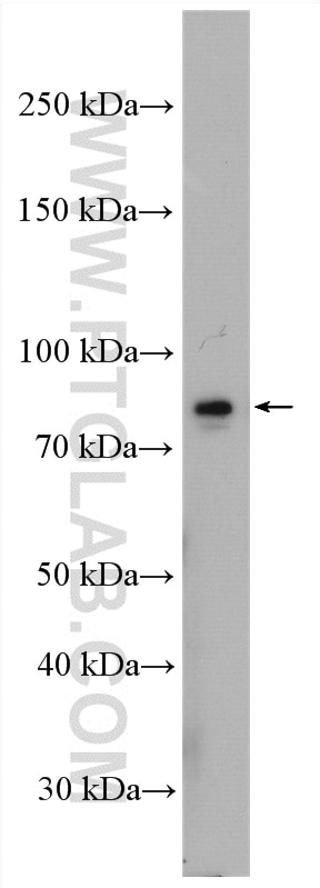 Western Blot (WB) analysis of mouse testis tissue using KIF2B Polyclonal antibody (13711-1-AP)