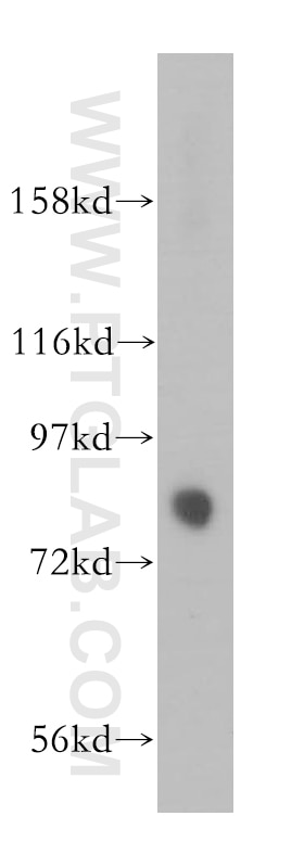 Western Blot (WB) analysis of mouse brain tissue using KIF2B Polyclonal antibody (13711-1-AP)