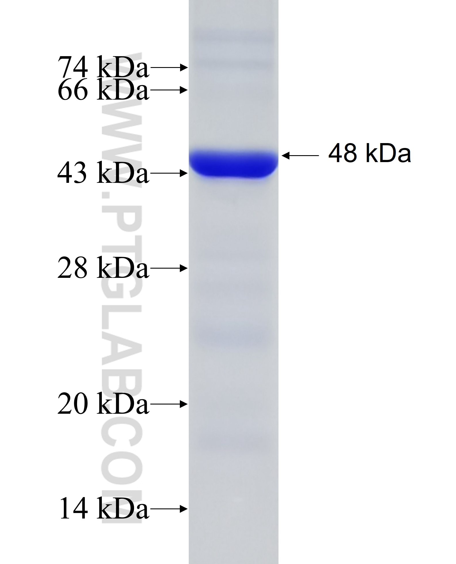 KIF2B fusion protein Ag28069 SDS-PAGE