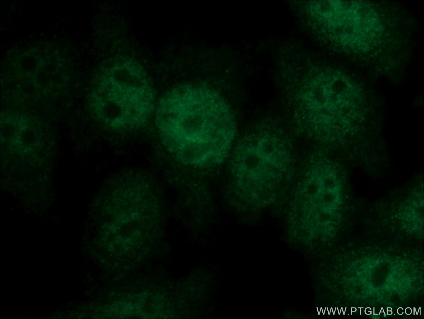 Immunofluorescence (IF) / fluorescent staining of HeLa cells using KIF2C Polyclonal antibody (12139-1-AP)