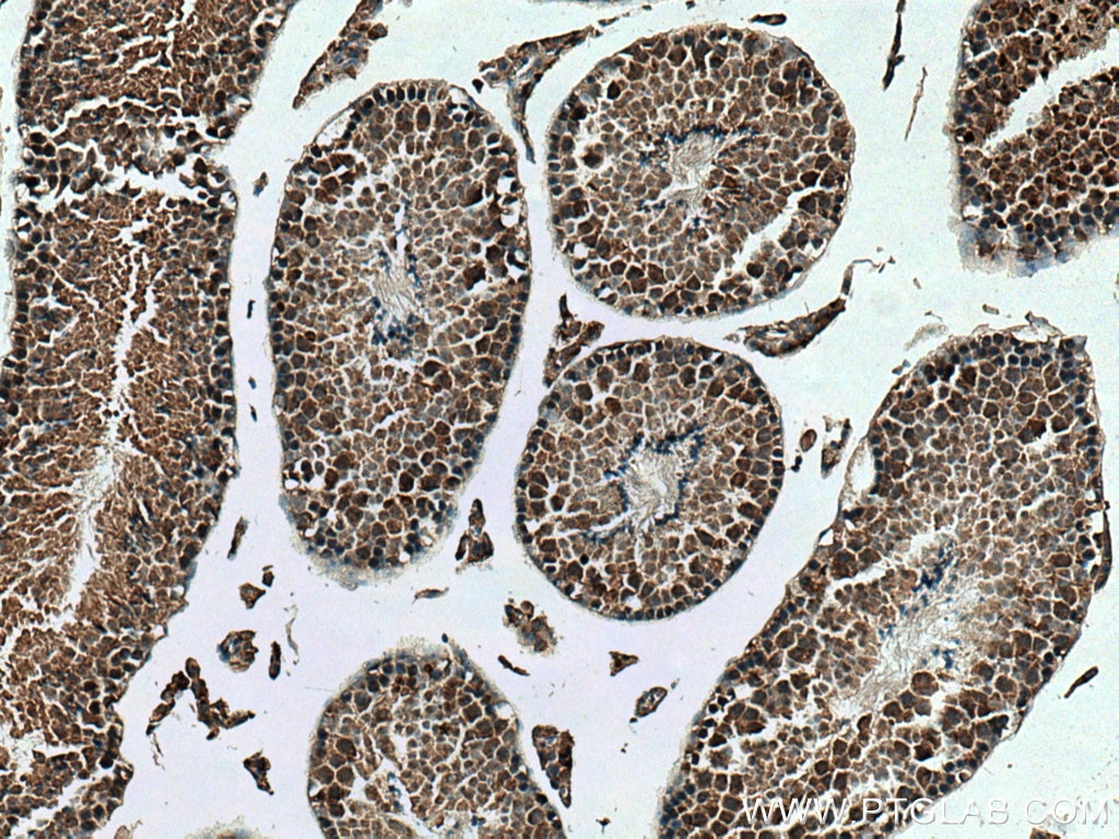 Immunohistochemistry (IHC) staining of mouse testis tissue using KIF2C Polyclonal antibody (28372-1-AP)