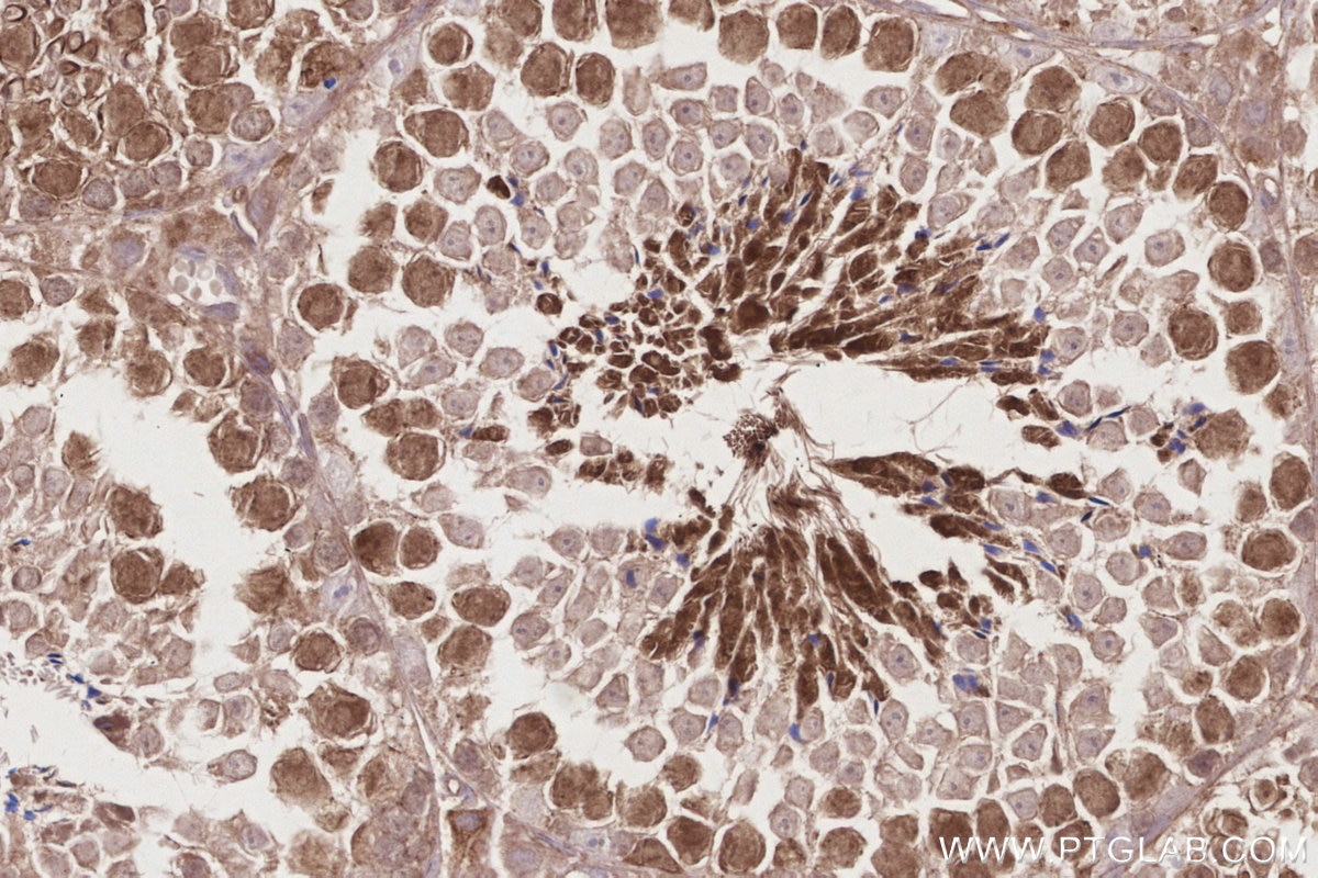 Immunohistochemistry (IHC) staining of mouse testis tissue using KIF2C Polyclonal antibody (28372-1-AP)