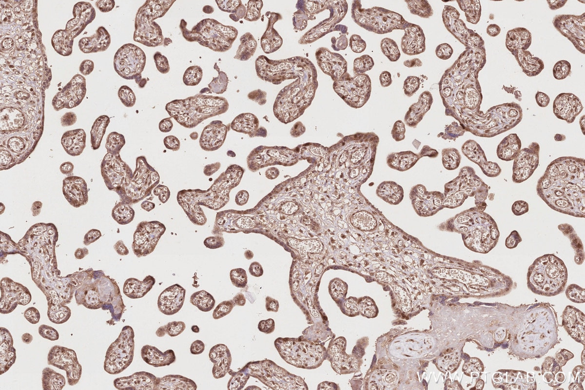 Immunohistochemistry (IHC) staining of human placenta tissue using KIF2C Polyclonal antibody (28372-1-AP)