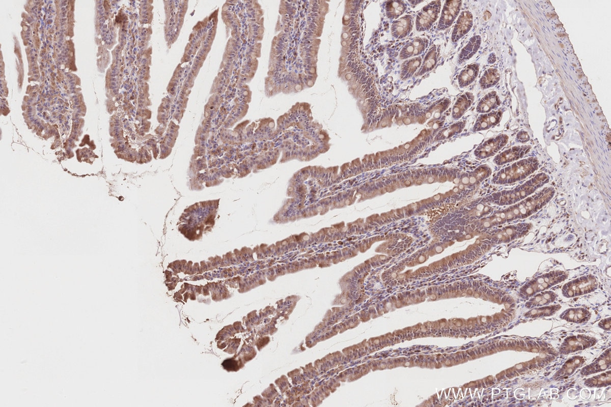 Immunohistochemistry (IHC) staining of rat small intestine tissue using KIF2C Polyclonal antibody (28372-1-AP)