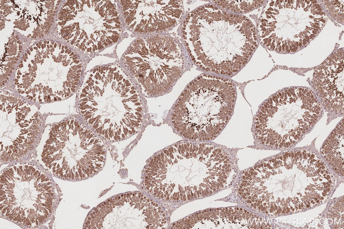 Immunohistochemistry (IHC) staining of rat testis tissue using KIF2C Polyclonal antibody (28372-1-AP)