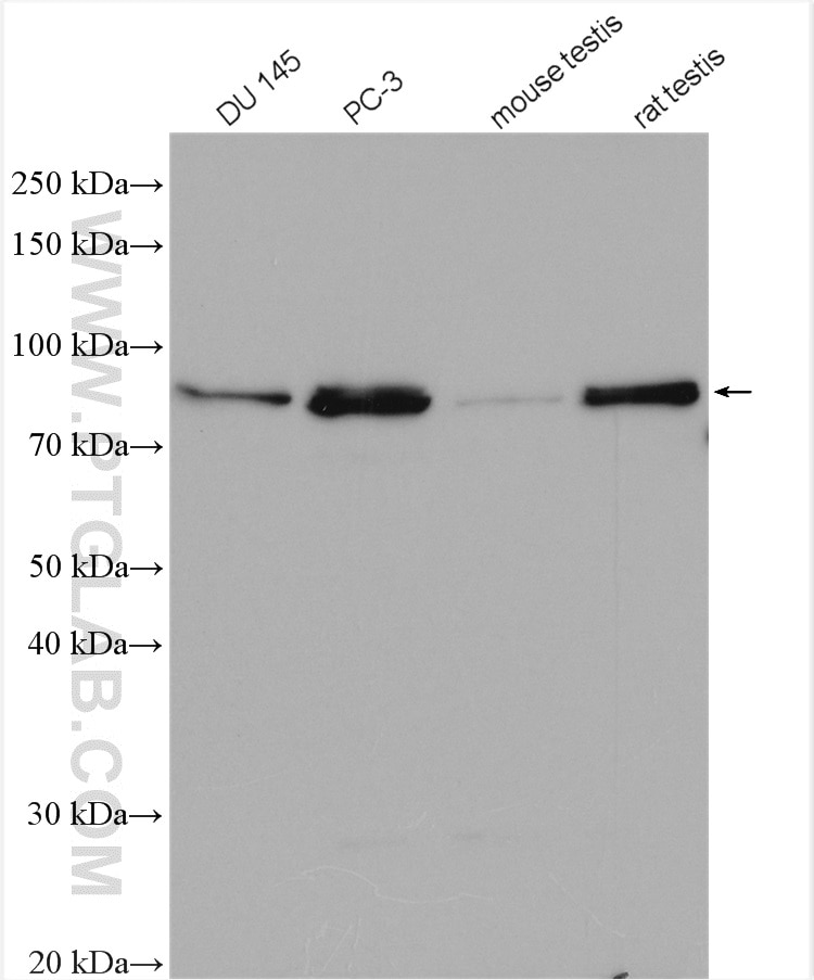 Western Blot (WB) analysis of various lysates using KIF2C Polyclonal antibody (28372-1-AP)