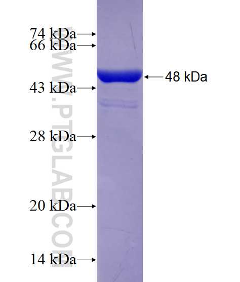 KIF2C fusion protein Ag29009 SDS-PAGE