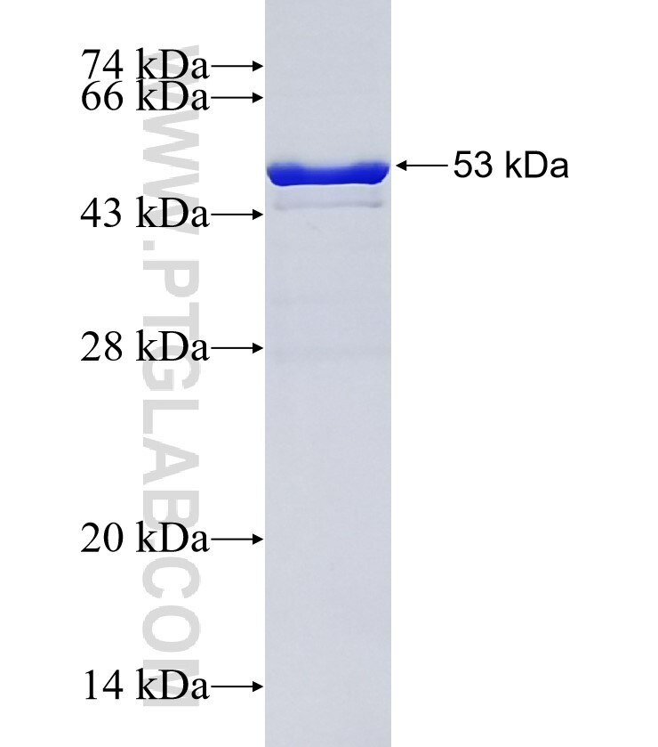 KIF2C fusion protein Ag2786 SDS-PAGE