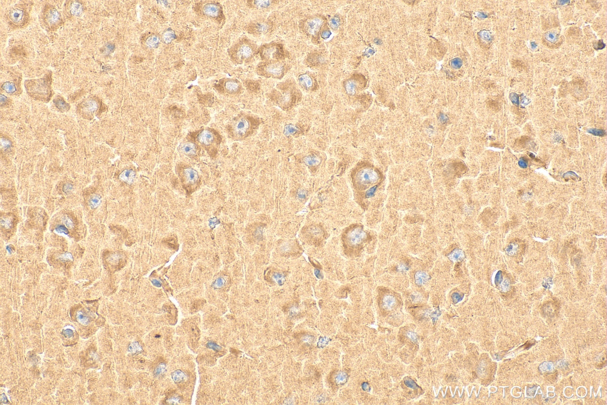 Immunohistochemistry (IHC) staining of mouse brain tissue using KIF3A Polyclonal antibody (13930-1-AP)