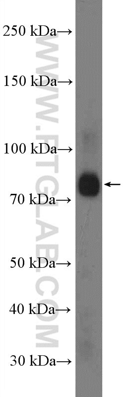 Western Blot (WB) analysis of mouse brain tissue using KIF3A Polyclonal antibody (13930-1-AP)