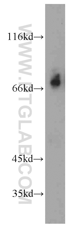 Western Blot (WB) analysis of mouse cerebellum tissue using KIF3A Polyclonal antibody (13930-1-AP)