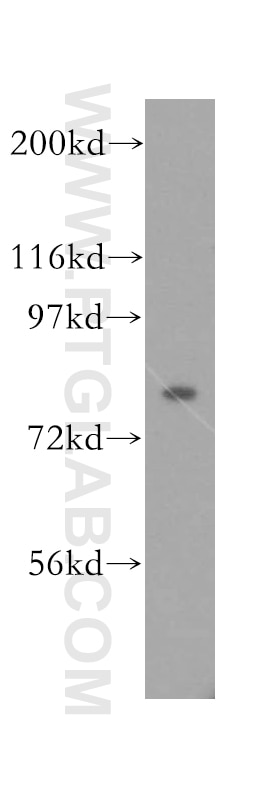 Western Blot (WB) analysis of human cerebellum tissue using KIF3A Polyclonal antibody (13930-1-AP)